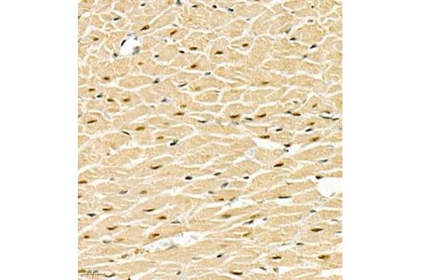SMNDC1 antibody