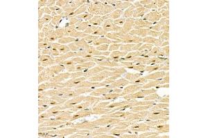 Immunohistochemistry of paraffin embedded rat heart using SMNDC1 (ABIN7075773) at dilution of 1:1000 (400x lens)