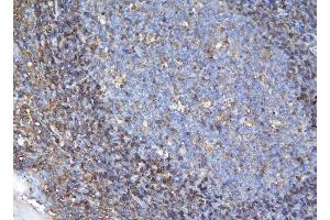 IHC analysis of APPL1 using anti-APPL1 antibody (ABIN7602658).