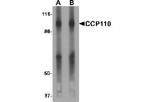 Western blot analysis of CCP110 in human colon tissue lysate with CCP110 antibody at (A) 1 and (B) 2 µg/mL. (CP110 antibody  (C-Term))