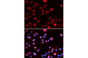 Immunofluorescence analysis of U2OS cells using MPG antibody. (MPG antibody  (AA 1-293))