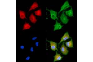 ABIN6258170 and ABIN6273862 staining  cells by IF/ICC. (GPR22 antibody  (N-Term))