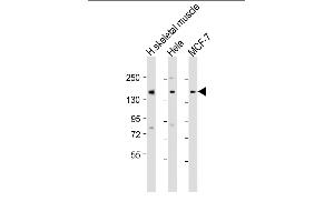 All lanes : Anti-TNRC6A Antibody (Center) at 1:1000-1:2000 dilution Lane 1: human skeletal muscle lysate Lane 2: Hela whole cell lysate Lane 3: MCF-7 whole cell lysate Lysates/proteins at 20 μg per lane. (TNRC6A antibody  (AA 855-885))