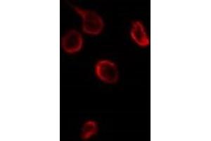 ABIN6276697 staining HuvEc by IF/ICC. (TIMP3 antibody  (Internal Region))