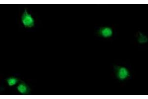 Anti-SDS mouse monoclonal antibody (ABIN2455307) immunofluorescent staining of COS7 cells transiently transfected by pCMV6-ENTRY SDS (RC217814). (serine Dehydratase antibody)