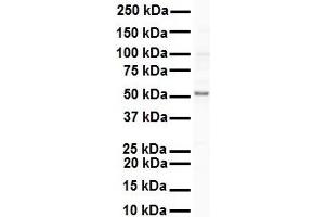 WB Suggested Anti-SNRP70 antibody Titration: 1 ug/mL Sample Type: Human Raji (SNRNP70 antibody  (N-Term))
