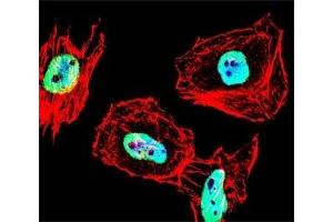 Fluorescent confocal image of HeLa cell stained with HDAC antibody at 1:25. (HDAC1 antibody  (AA 402-430))