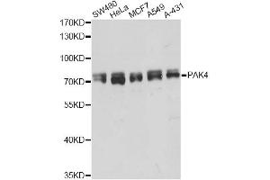 Western blot analysis of extracts of various cell lines, using PAK4 antibody (ABIN5998444) at 1/5000 dilution. (PAK4 antibody)