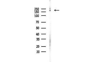 anti-Minichromosome Maintenance Complex Component 3 Associated Protein (MCM3AP) (C-Term) antibody
