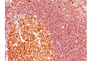 Formalin-fixed, paraffin-embedded human Tonsil stained with MALT1 Mouse Monoclonal Antibody (MT1/410). (MALT1 antibody  (AA 701-808))
