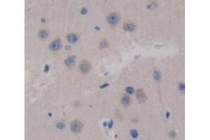 IHC-P analysis of brain tissue, with DAB staining. (Glutaminase antibody  (AA 31-253))