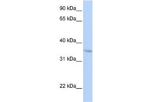WB Suggested Anti-FHL3 Antibody Titration:  0. (FHL3 antibody  (Middle Region))
