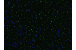 Immunofluorescence staining of an infarcted porcine heart with anti-CD105 (MEM-229 ; (Endoglin antibody)