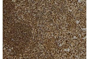 ABIN6276780 at 1/100 staining Mouse spleen tissue by IHC-P. (DTNBP1 antibody  (C-Term))