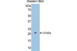 Detection of Recombinant PPARd, Mouse using Polyclonal Antibody to Peroxisome Proliferator Activated Receptor Delta (PPARd) (PPARD antibody  (AA 260-426))