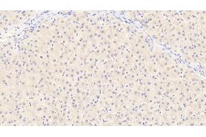 Detection of ALB in Human Liver Tissue using Monoclonal Antibody to Albumin (ALB) (Albumin antibody)