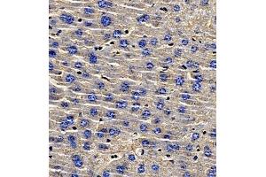 Immunohistochemistry (Paraffin-embedded Sections) (IHC (p)) image for anti-alpha-2-HS-Glycoprotein (AHSG) antibody (ABIN7073021)
