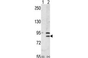 Western Blotting (WB) image for anti-Bromodomain Containing 2 (BRD2) antibody (ABIN3003651) (BRD2 antibody)