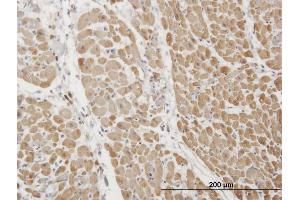 Immunoperoxidase of monoclonal antibody to TNNI3 on formalin-fixed paraffin-embedded human heart. (TNNI3 antibody  (AA 102-210))