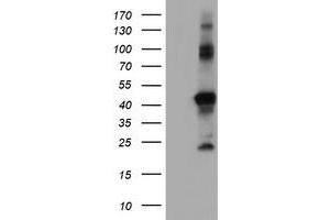 HEK293T cells were transfected with the pCMV6-ENTRY control (Left lane) or pCMV6-ENTRY RNF113B (Right lane) cDNA for 48 hrs and lysed. (RNF113B antibody)