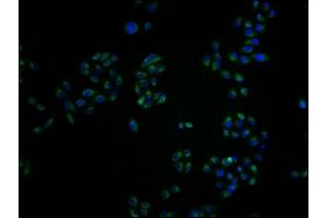Immunofluorescence staining of Hela cells with ABIN7161163 at 1:100, counter-stained with DAPI. (MME antibody  (AA 386-617))