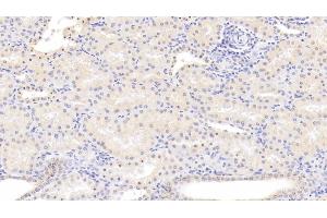 Detection of ALOX15 in Human Kidney Tissue using Monoclonal Antibody to Arachidonate-15-Lipoxygenase (ALOX15) (ALOX15 antibody  (AA 170-312))