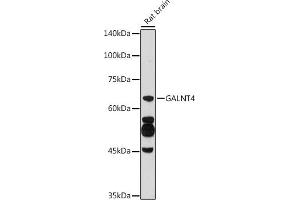 Western blot analysis of extracts of Rat brain, using G antibody (ABIN6135078, ABIN6140946, ABIN7101653 and ABIN7101654) at 1:500 dilution.
