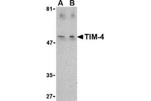Western blot analysis of TIM-4 in Jurkat lysate with this product at (A) 1 and (B) 2 μg/ml.