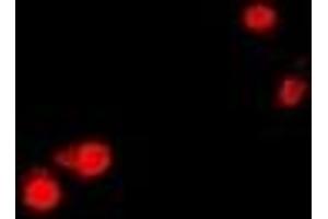 Immunofluorescent analysis of CTNNBL1 staining in U2OS cells. (CTNNBL1 antibody)
