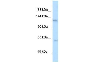 Western Blot showing Ttbk2 antibody used at a concentration of 1.