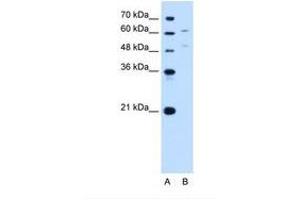 Image no. 1 for anti-UDP Glucuronosyltransferase 1 Family, Polypeptide A4 (UGT1A4) (AA 59-108) antibody (ABIN6749736) (UGT1A4 antibody  (AA 59-108))