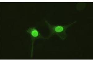 Anti-AK1 mouse monoclonal antibody (AK1) immunofluorescent staining of HeLa cells transiently transfected by pCMV6-ENTRY AK1 (RC215130). (Adenylate Kinase 1 antibody)