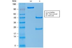 SDS-PAGE Analysis of Purified TP53 Mouse Recombinant Monoclonal Antibody ABIN6383817. (Recombinant p53 antibody)