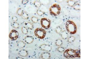 Used in DAB staining on fromalin fixed paraffin- embedded kidney tissue (KRT17 antibody  (AA 252-393))