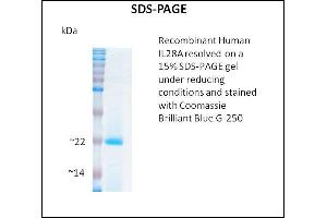 SDS-PAGE (SDS) image for Interleukin 28A (Interferon, lambda 2) (IL28A) (Active) protein (ABIN5509786) (IL28A Protein)