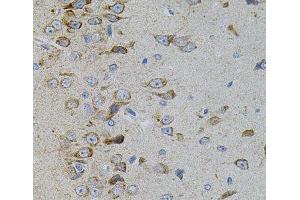 Immunohistochemistry of paraffin-embedded Rat brain using MAPK11 Polyclonal Antibody (MAPK11 antibody)