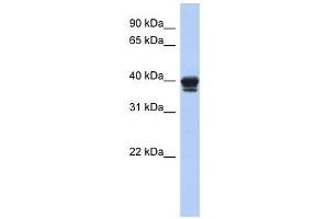 NAPE-PLD antibody used at 1 ug/ml to detect target protein. (NAPEPLD antibody  (N-Term))