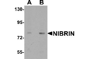 Western blot analysis of NIBRIN in rat lung tissue lysate with NIBRIN antibody at (A) 1 and (B) 2 µg/mL.