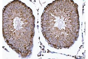 IHC analysis of CSNK2K2 using anti-CSNK2K2 antibody (ABIN7602871). (CSNK2A2 antibody  (C-Term))
