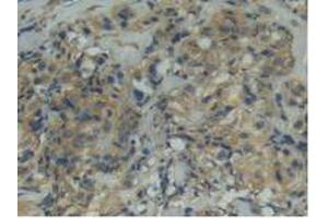 Figure. (ITGAD antibody  (AA 879-1099))