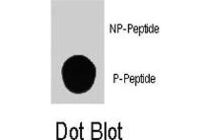 Dot blot analysis of PIK3C3 (phospho S164) polyclonal antibody  on nitrocellulose membrane. (PIK3C3 antibody  (pSer164))