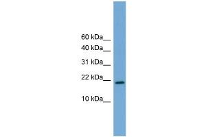 WB Suggested Anti-Cited4 Antibody Titration:  0.
