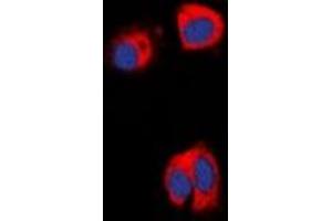 Immunofluorescent analysis of AAK1 staining in HepG2 cells. (AAK1 antibody)