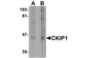 Western blot analysis of CKIP1 in human lung tissue lysate with AP30235PU-N CKIP1 antibody at (A) 1 and (B) 2 μg/ml. (PLEKHO1 antibody  (C-Term))