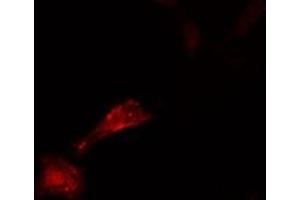 ABIN6276576 staining  HeLa cells by IF/ICC. (CDC25A antibody  (N-Term))