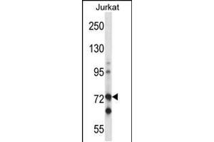 Western blot analysis in Jurkat cell line lysates (35ug/lane).