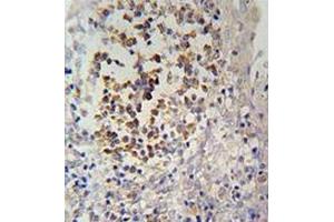 Immunohistochemistry analysis in human tonsils tissue (formalin-fixed, paraffin-embedded) using IL12RB2  Antibody (C-term), followed by peroxidase conjugation of the secondary antibody and DAB staining. (IL12RB2 antibody  (C-Term))