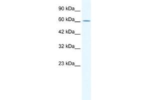 WB Suggested Anti-ZNF21 Antibody Titration:  0. (ZNF182 antibody  (Middle Region))