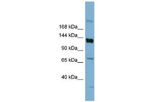 Western Blotting (WB) image for anti-ATP-Binding Cassette, Sub-Family B (MDR/TAP), Member 4 (ABCB4) (Middle Region) antibody (ABIN2776967)