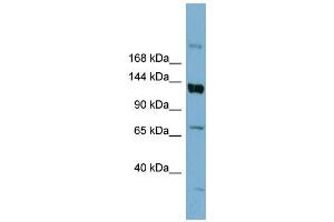 WB Suggested Anti-ABCB4  Antibody Titration: 0. (ABCB4 antibody  (Middle Region))